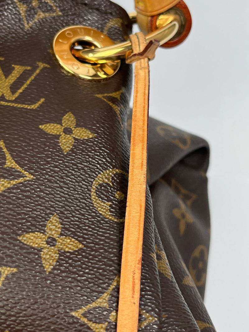 louis vuitton artsy fake vs real